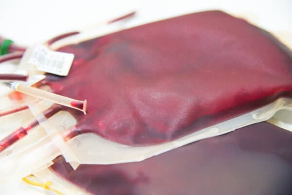 Transfusionsmanagement (Ärztliche Mitarbeiter*innen)