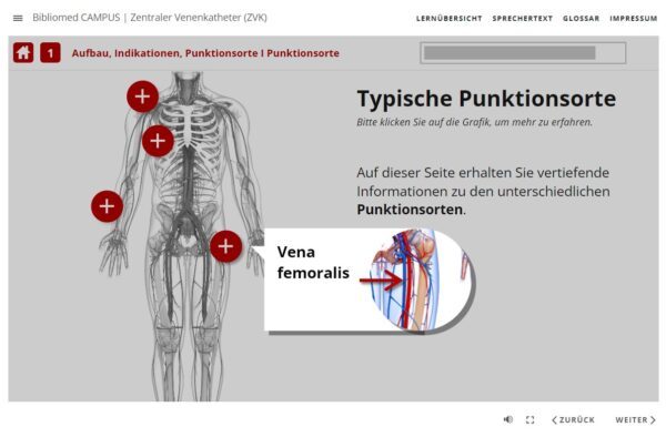 Zentraler Venenkatheter – Bild 11